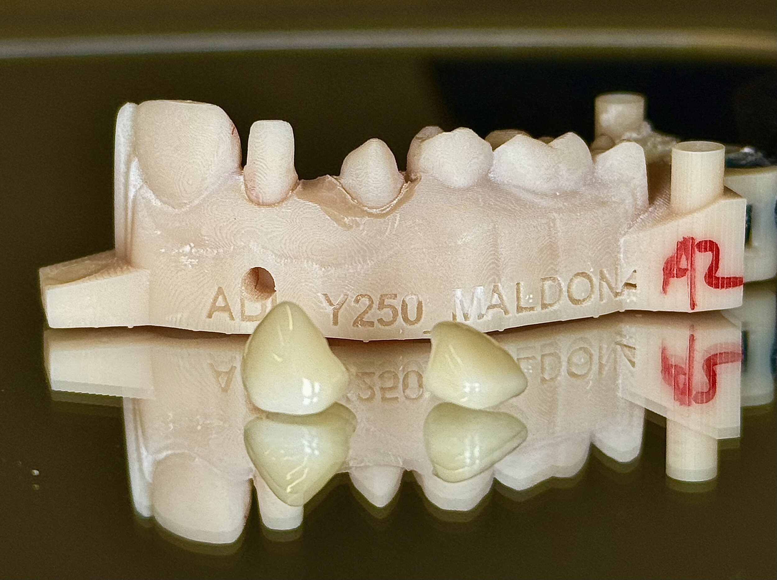 Before and After Image: Crowns - front