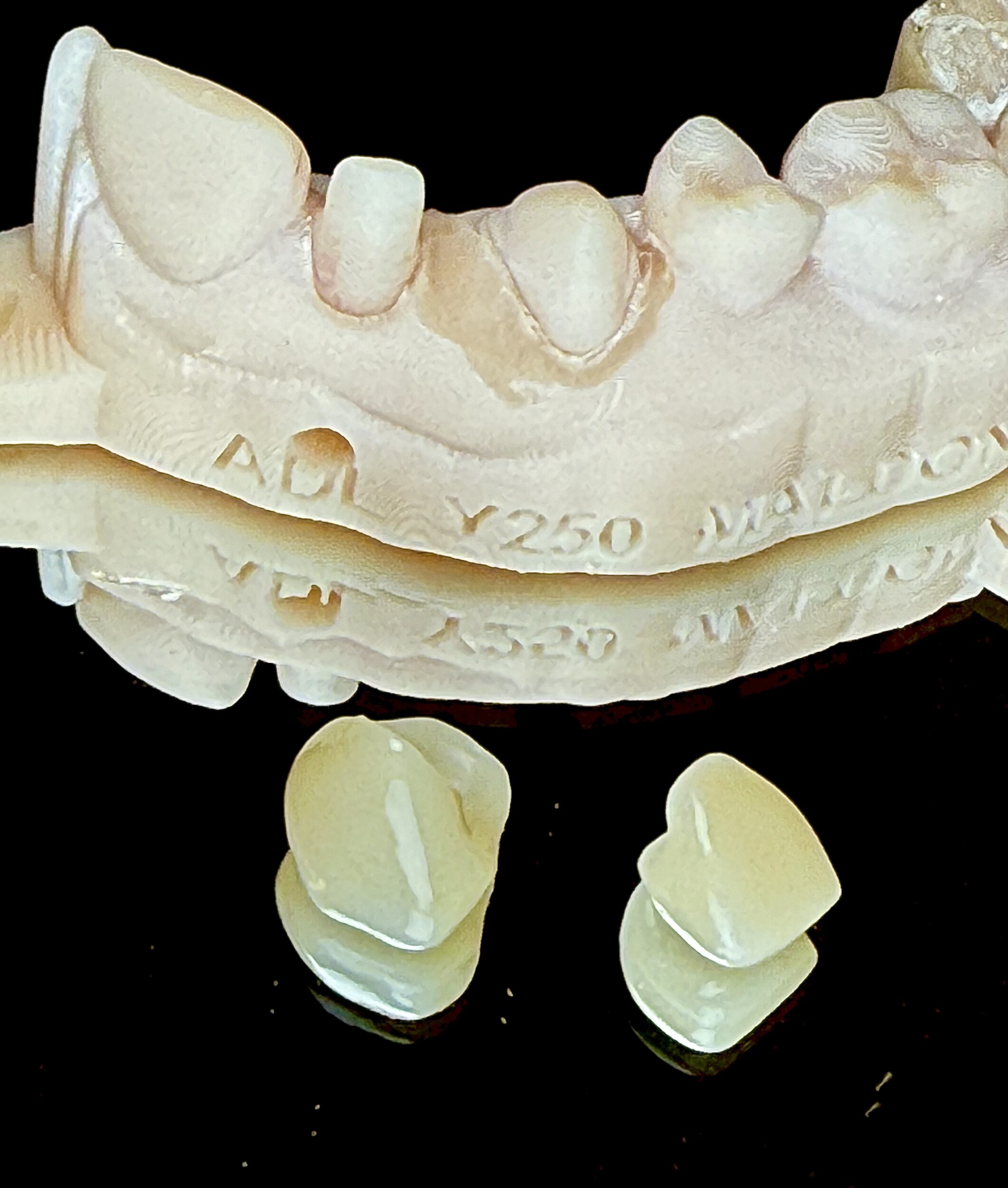 Before and After Image: Crowns - front