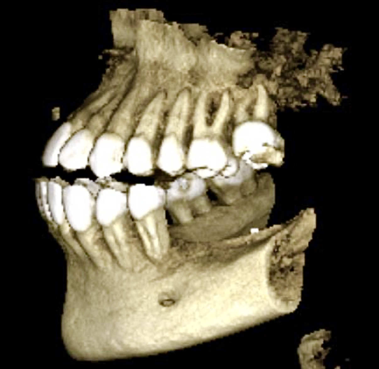 Before and After Image: Digital Dentistry - left-side