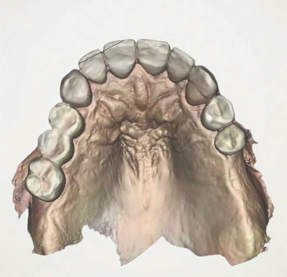 Before and After Image: Digital Dentistry - front