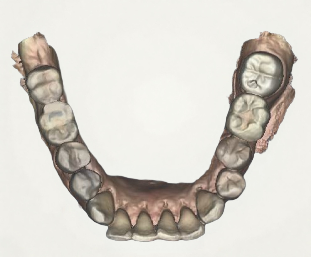 Before and After Image: Digital Dentistry - other
