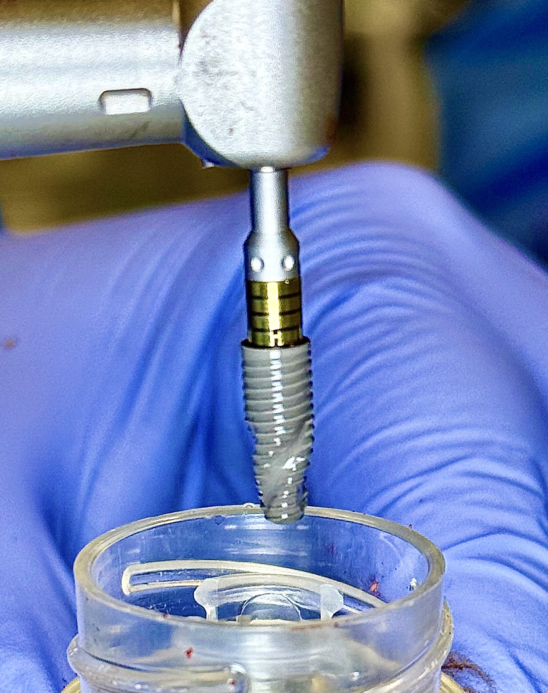 Before and After Image: Implants - front