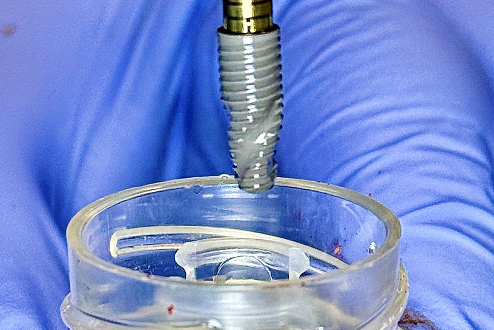 dental-implant Implantes dentales en Wilmington, Delaware