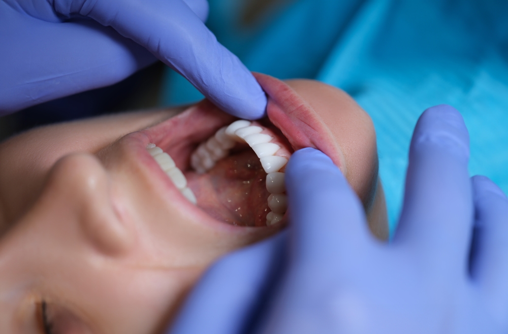 Dentist examining a patient’s teeth during a general dental exam.